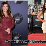 Celebrities with Lipedema